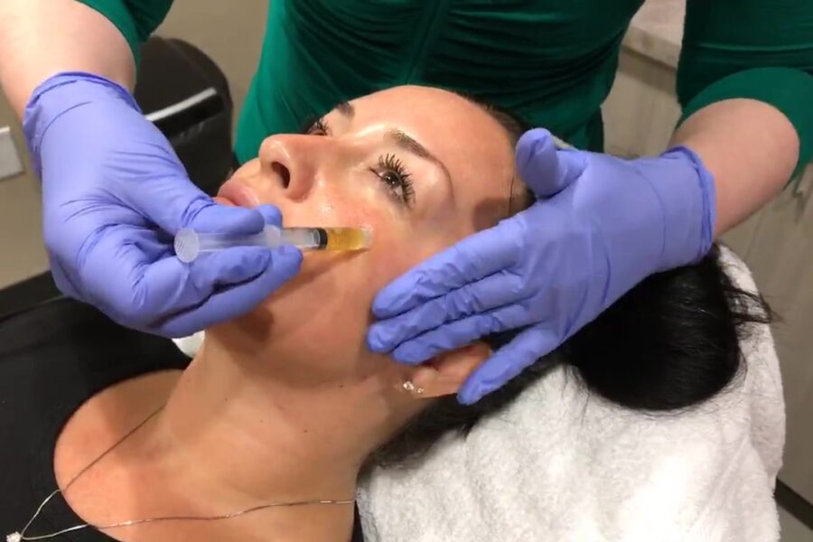 PRP Facial in our Scottsdale medspa