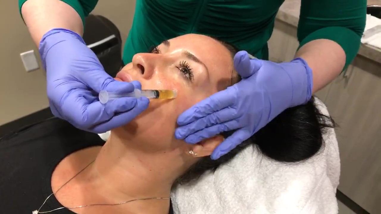 PRP Facial in our Scottsdale medspa