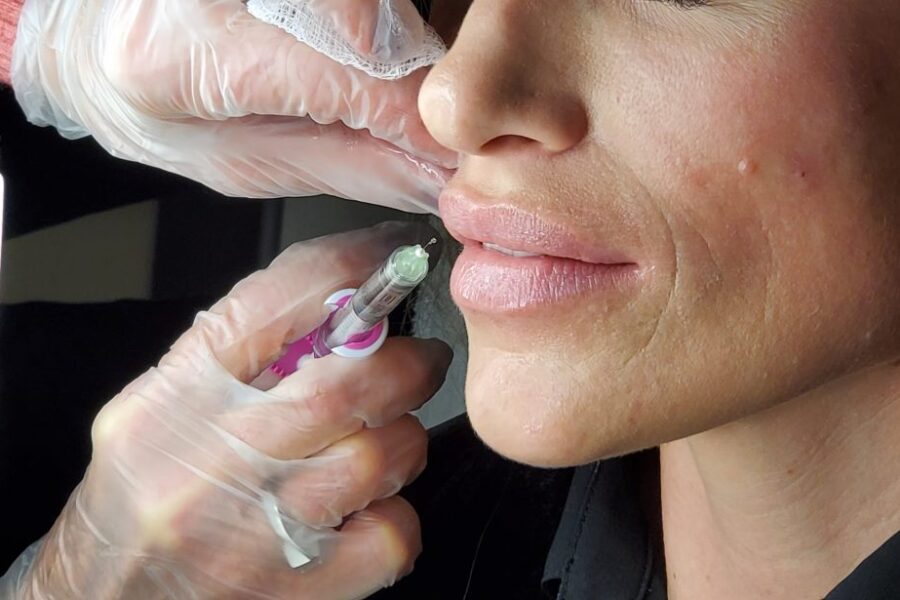 scottsdale lips treatment using injectables