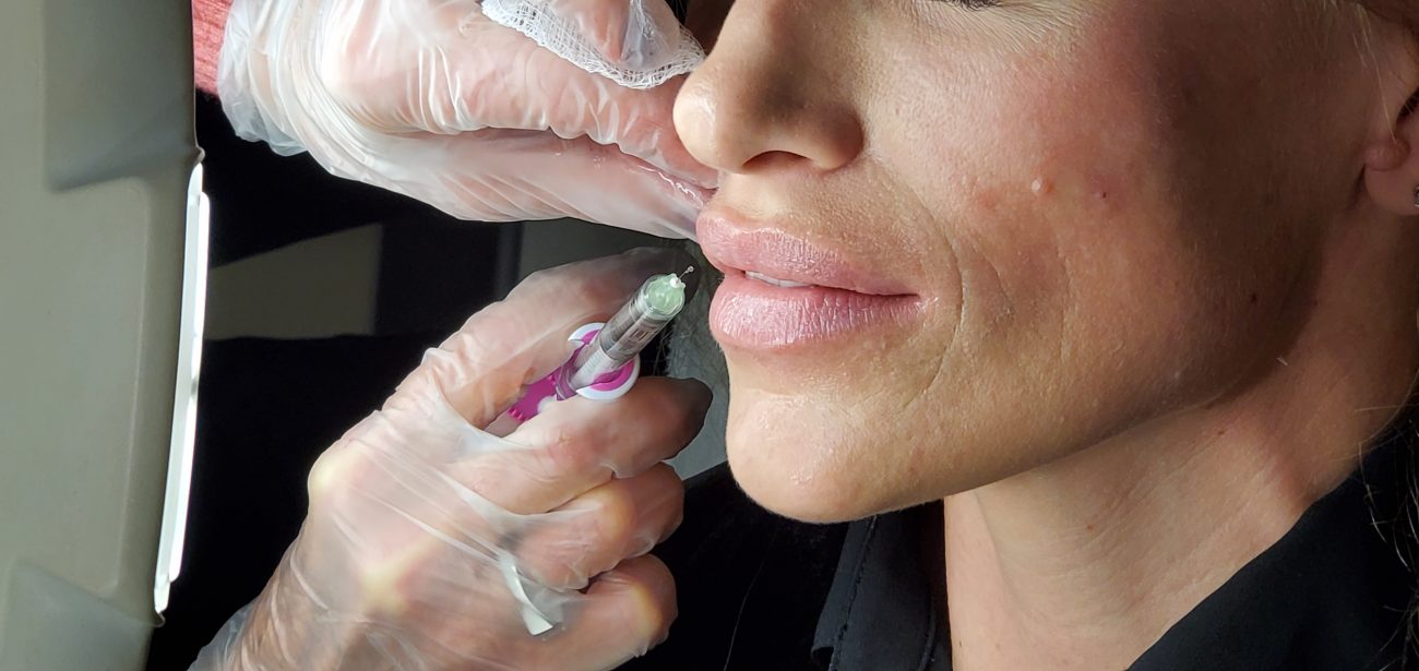 scottsdale lips treatment using injectables