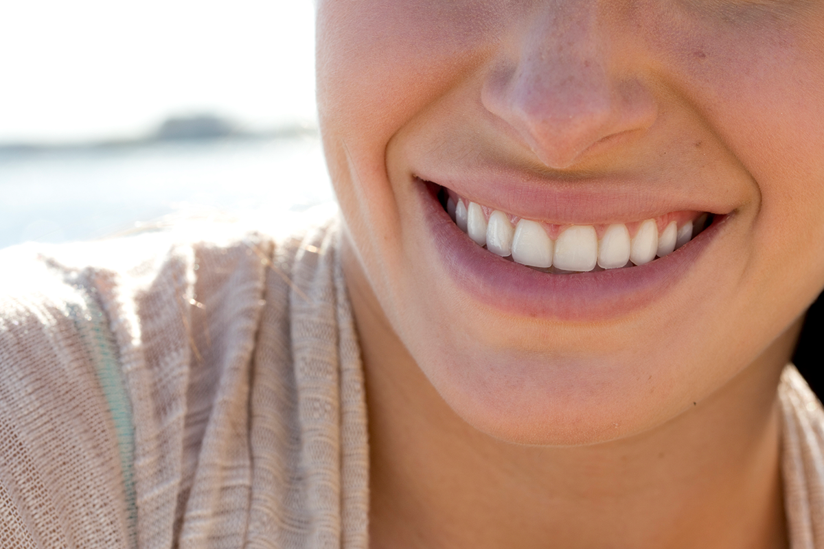 Woman with young, bright skin after Restylane Kysse in Scottsdale.