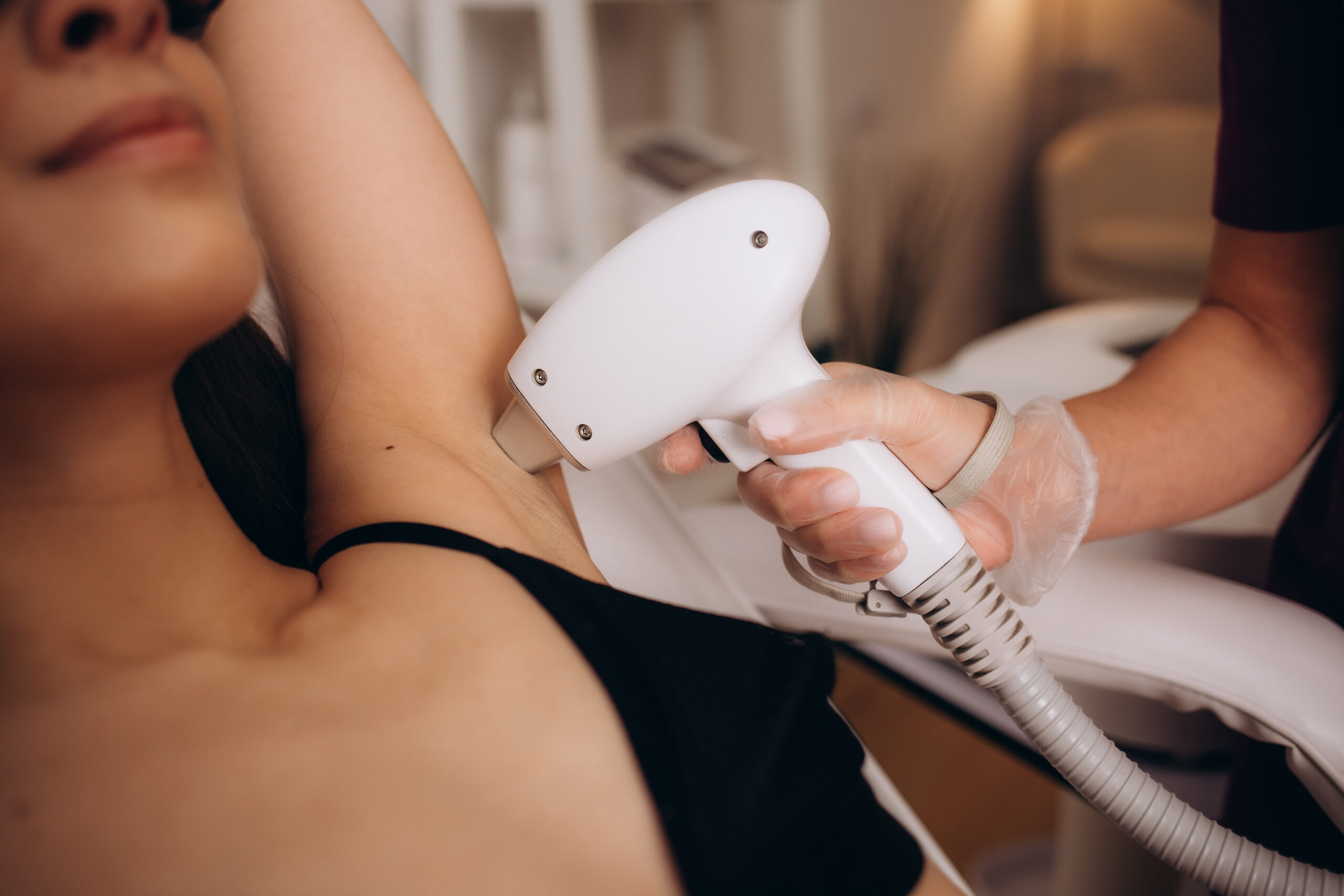 Woman getting laser hair removal in Scottsdale